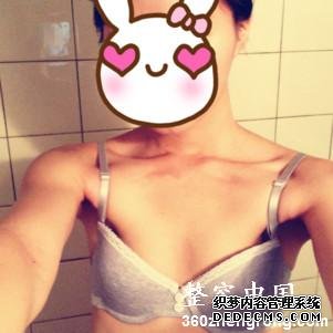【真人案例】北京伟力嘉美信医疗美容门诊部马永奇医生隆胸案例:美国曼托琴面硅胶假体丰胸"